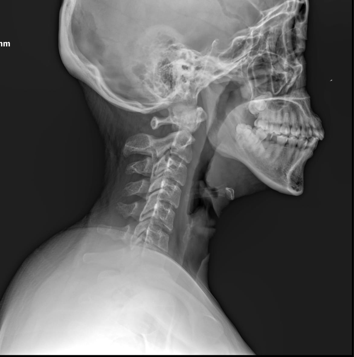 Estudio DICOM